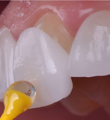 seoulteam dental clinic modern treatment room