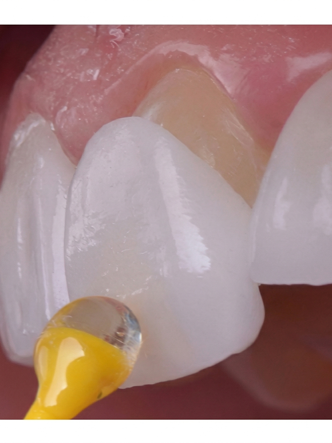 고양시-루미네이트-잘하는-곳e