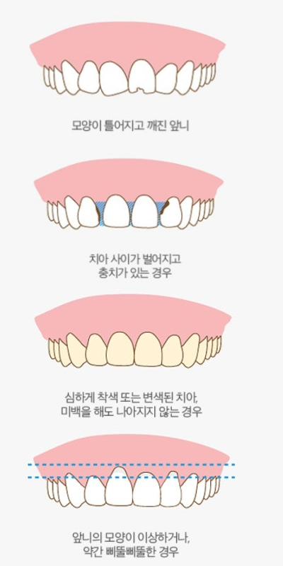 고양시-루미네이트-잘하는-곳