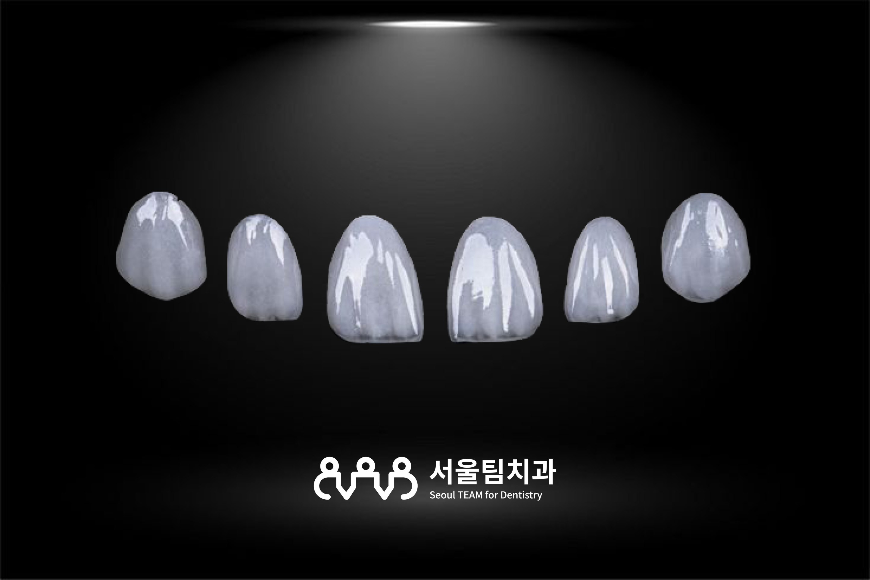 무삭제 라미네이트에 사용되는 0.2~0.5mm 초박형 세라믹 쉘