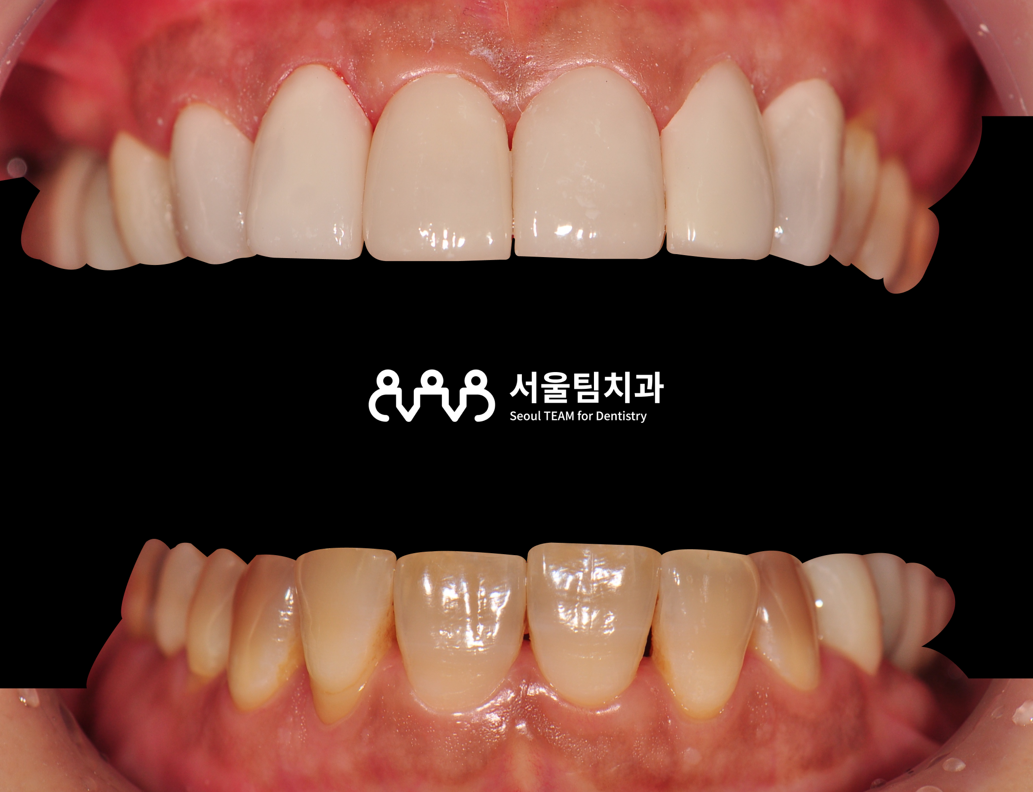원신동치과 루미네이트